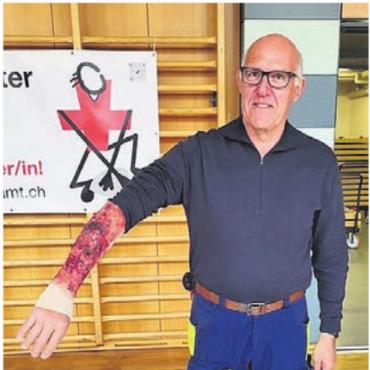 Erste Hilfe hautnah erleben - Täuschend echt, aber nur eine Moulage.