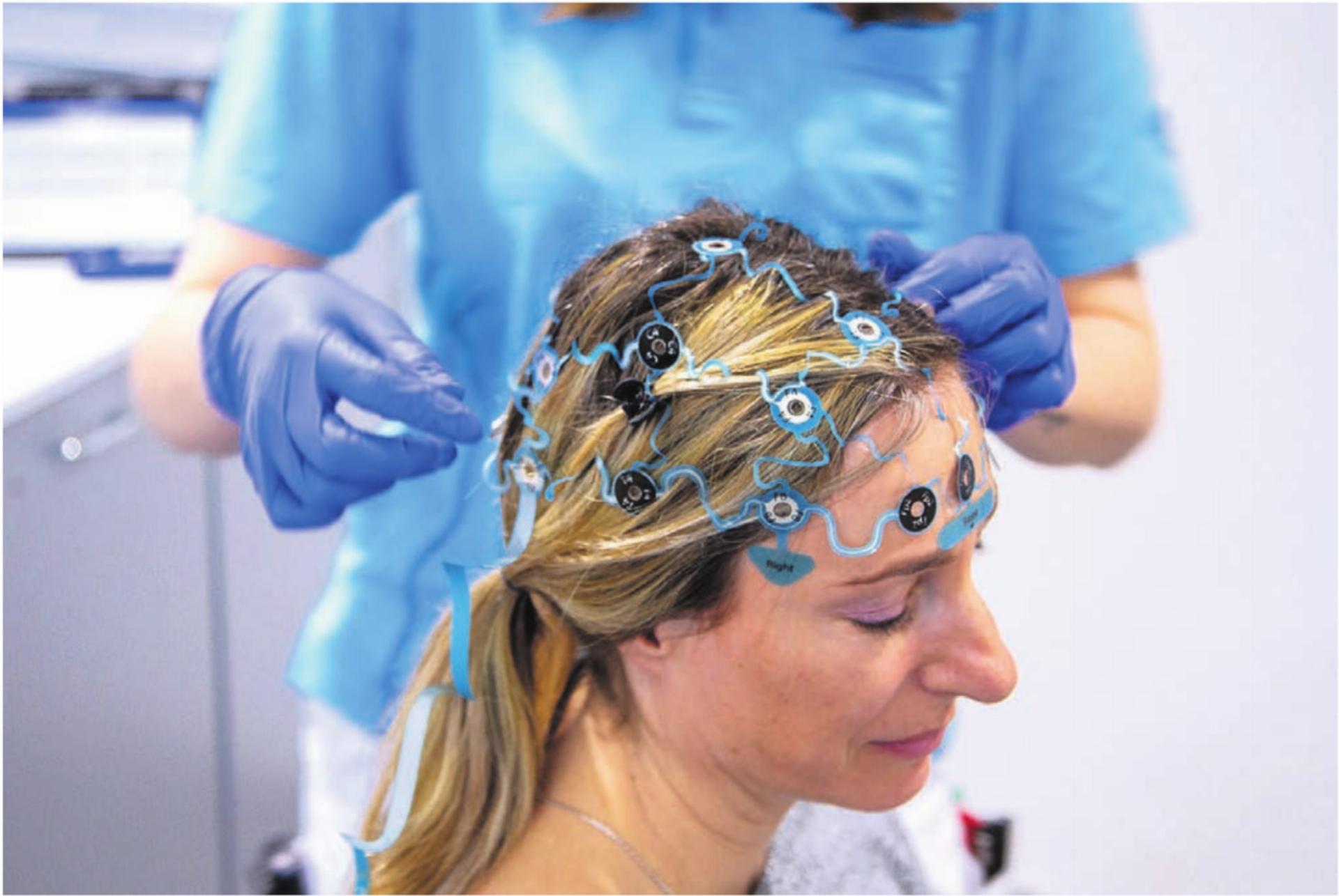 Mit dem stationären Langzeit-EEG hat das Spital Muri sein Angebot an neurologischer Diagnostik erweitert. Auf der Kopfhaut der untersuchten Person werden bis zu 21 Elektroden gleichmässig platziert, um die Hirnströme aufzuzeichnen. Bild: zg - Das Bild wird blockiert. – Möglicherweise durch einen aktiven Adblocker.